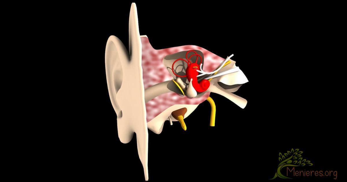 treatment for ringing in the ear from tinnitus 1200x630